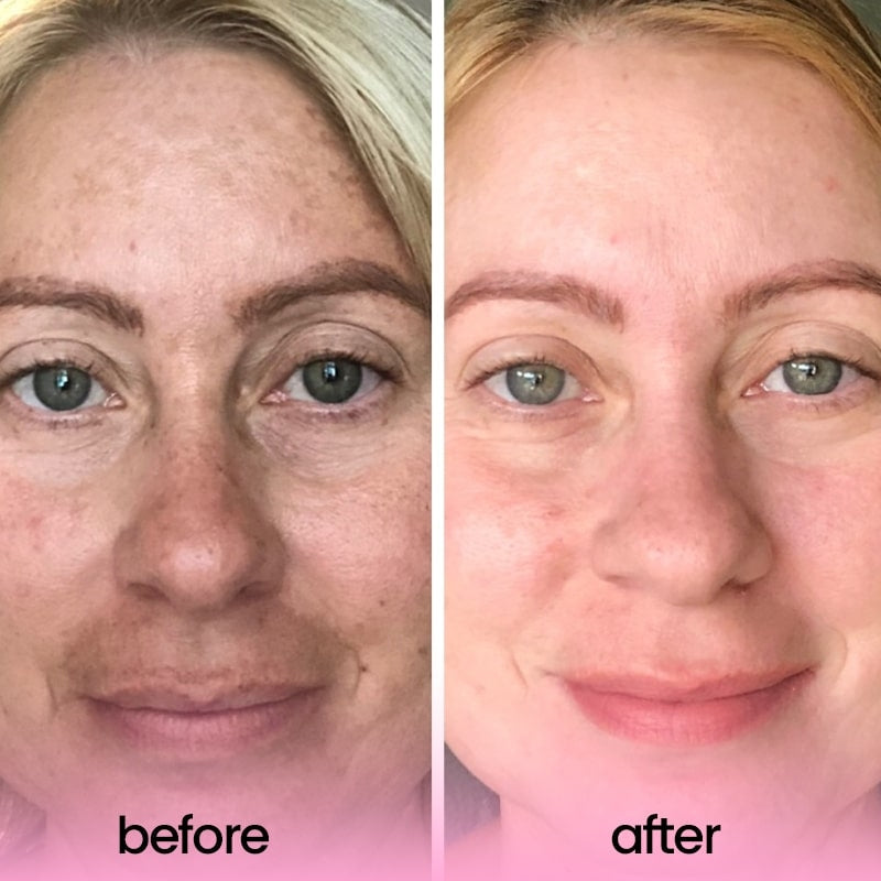 KojiPure: Viral Turmeric & Kojic Acid Cleansing Pads
